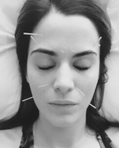 Sinus Infection Sinusitis Treatment With Acupuncture Acupuncture