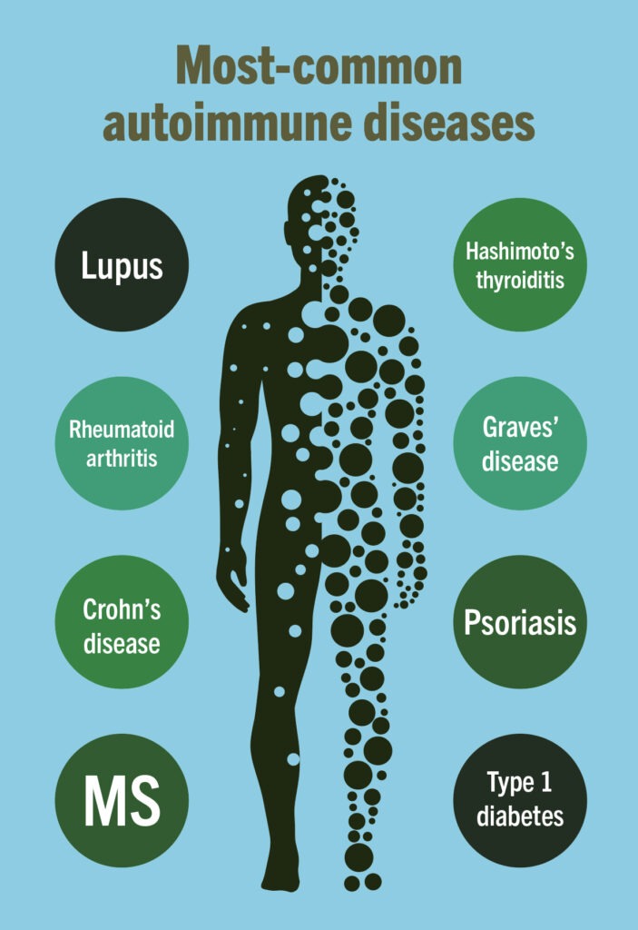 Using Acupuncture to Treat Autoimmune Diseases