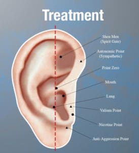 Quit Smoking Acupuncture Treatment Columbus Ohio Clintonville 