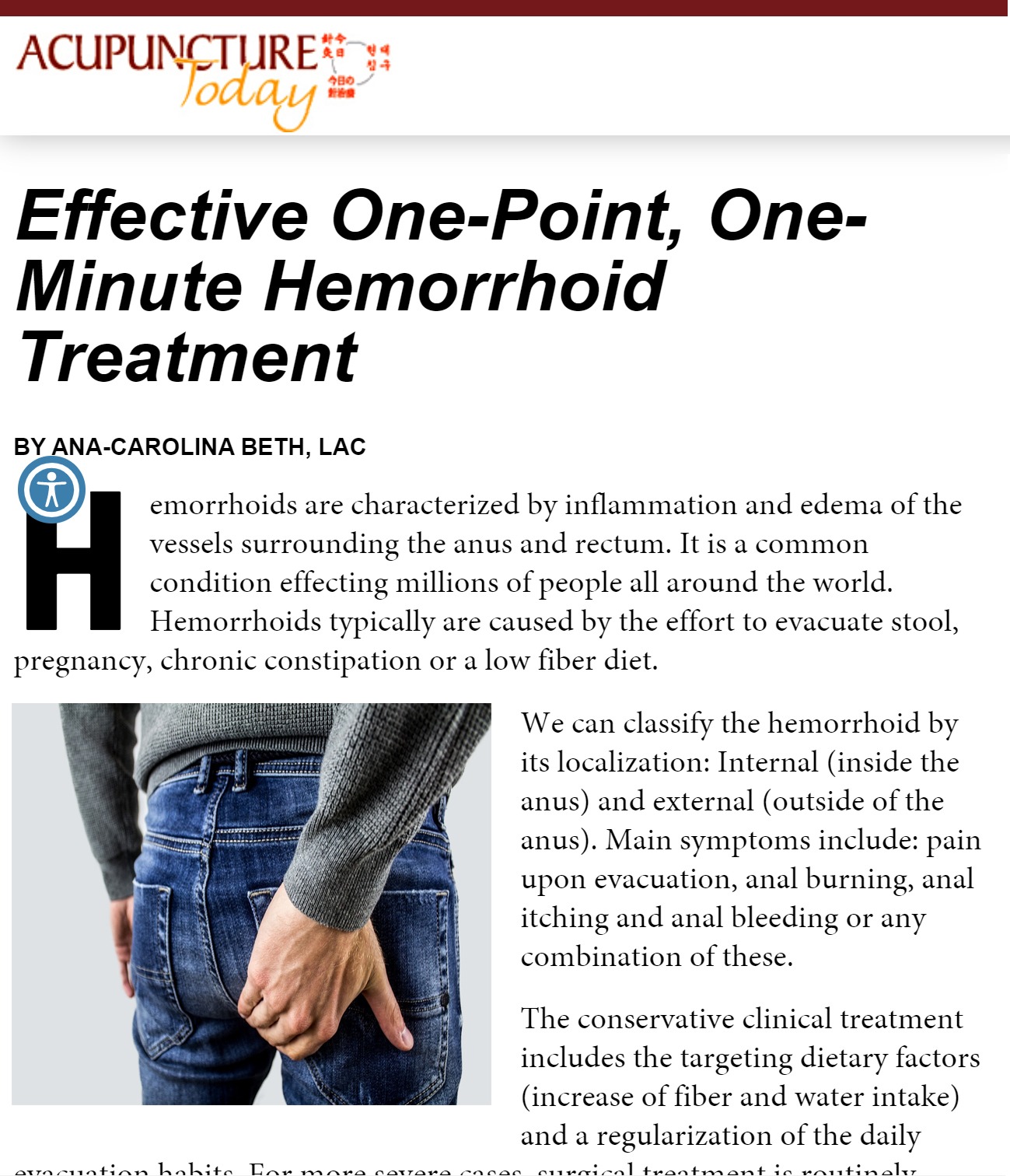 Hemorrhoid treatment with acupuncture Columbus Ohio | Westerville |  Clintonville
