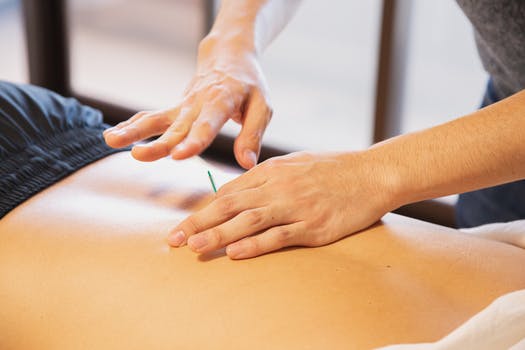 Fertility Acupuncture, London