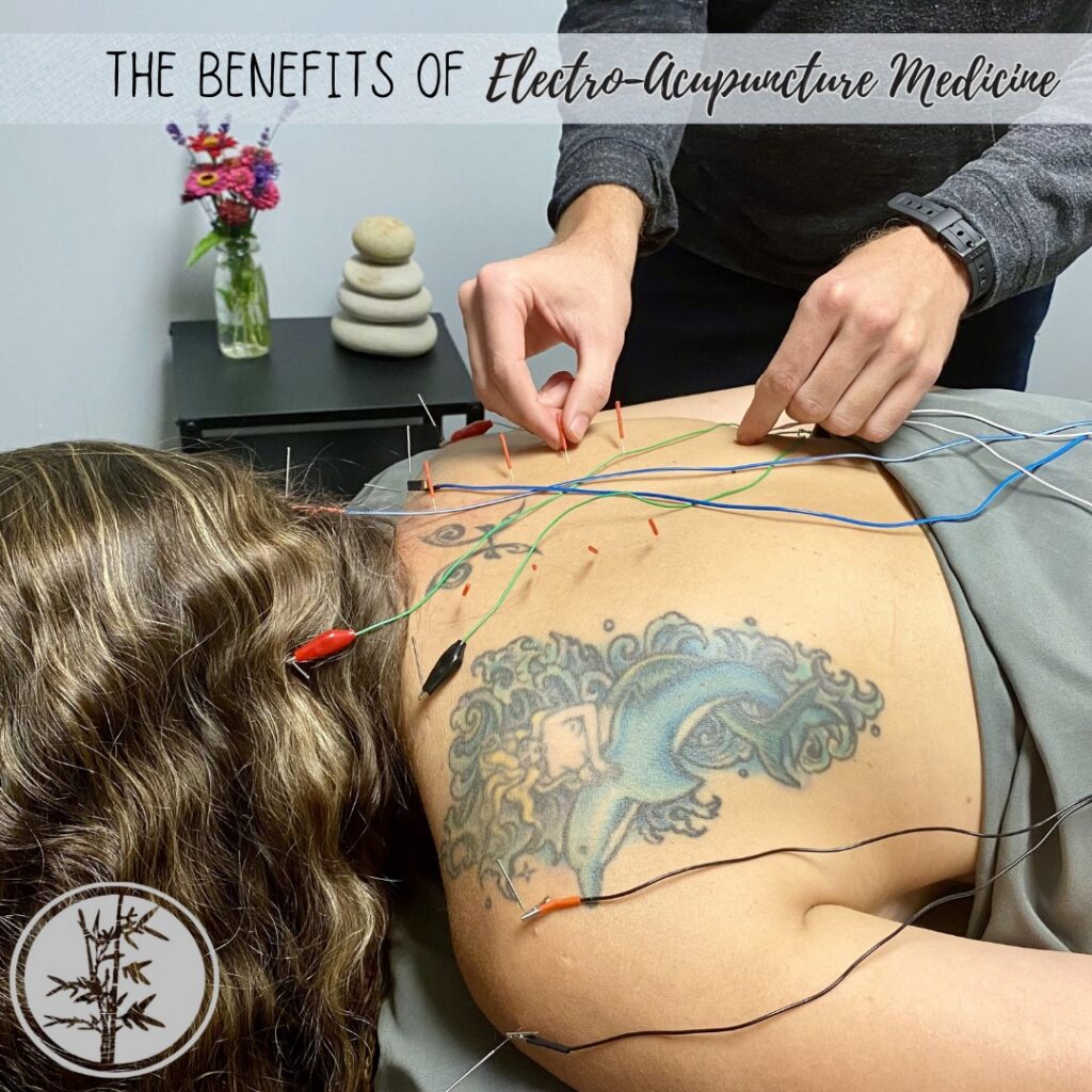 What is Electroacupuncture Medicine (EAM)?